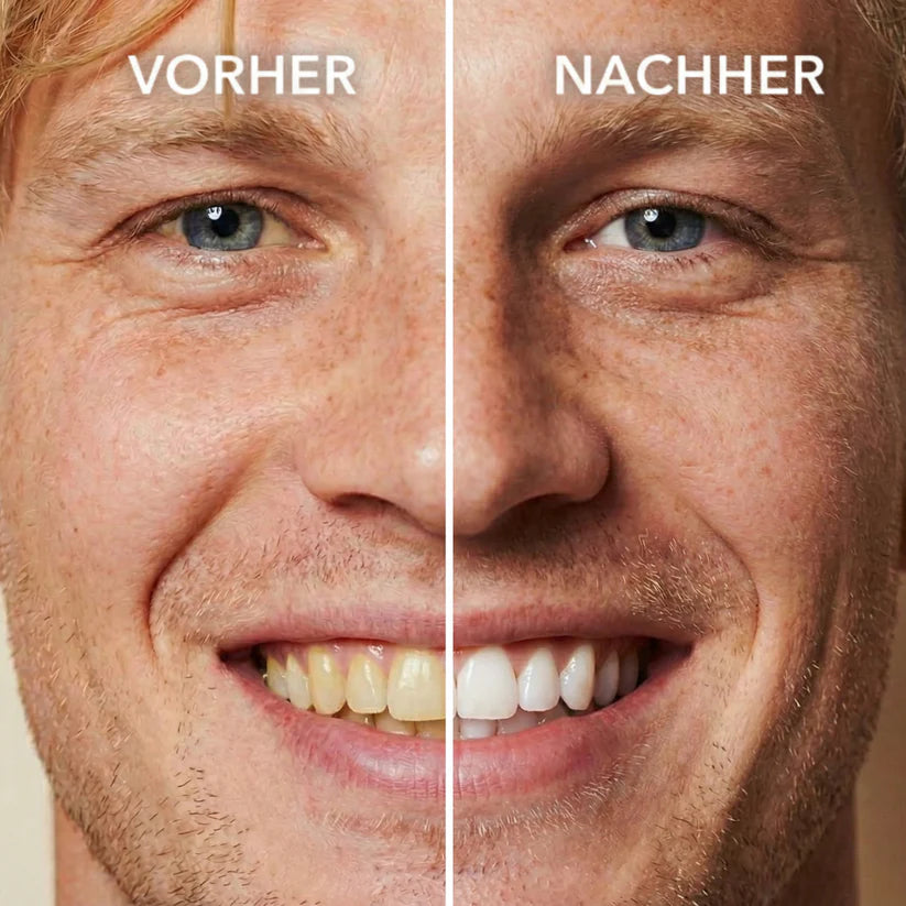 Getrosna™ Tooth Polish