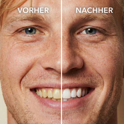 Getrosna™ Tooth Polish